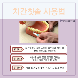 잇몸에서 피날때 치간칫솔사용